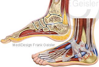 Hallux valgus – Schmerzhaftes Überbein