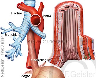 Hauptschlagader Aorta Aortenenge Isthmus aortae mit Luftröhre Trachea und Speiseröhre Oesophagus