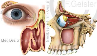 Auge Augapfel mit Augenhöhle Nasenhöhle und Kieferhöhle