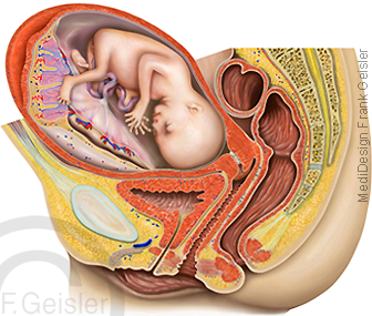 Becken der Frau, Lage Fetus Fötus mit Plazenta