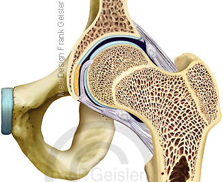 Anatomie Hüftgelenk der Hüfte, Hüfte mit Oberschenkelknochen Femur und Beckenknochen
