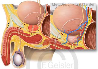 Organe Geschlechtsorgane Mann, Becken mit Vorsteherdrüse Prostata