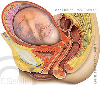 Becken der Frau, Fetus Fötus in Fruchtblase