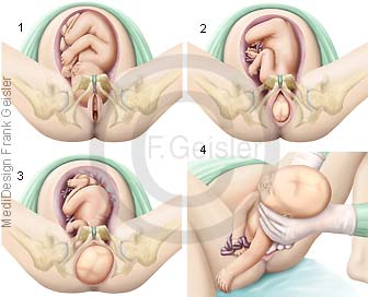 Geburt Kind, Geburtsphasen bei Geburt eines Kindes