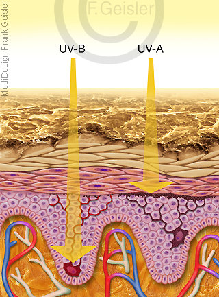 UV-Licht auf Haut, Melanozyten in Dermis Epidermis