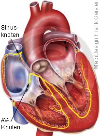 Herz, Erregung Erregungsleitungssystem mit Sinusknoten AV-Knoten