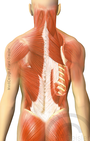 Anatomie oberflächliche und tiefe Muskeln Muskulatur am Rücken