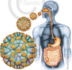 Gastroenteritis durch Norovirus