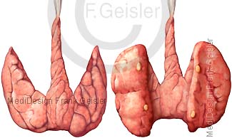 Anatomie Schilddrüse mit Mittellappen und Nebenschilddrüsen von dorsal
