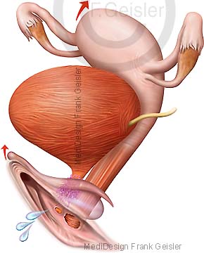 Anatomie Vulva mit Klitoris, weibliche Prostata und Gebärmutter Uterus