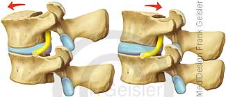 Bewegung Wirbel der Wirbelsäule mit Bandscheibe