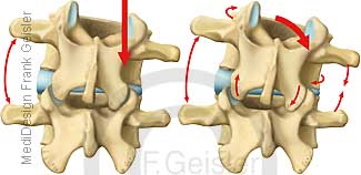 Neigung und Drehung Wirbel der Wirbelsäule